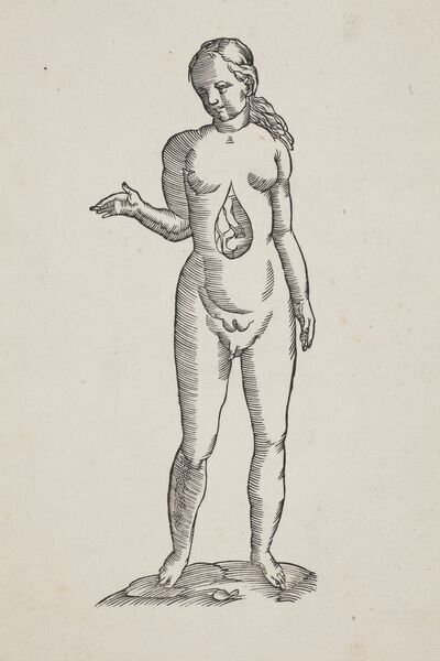 Download the full-sized image of Woodcut Anatomical Illustration of an Intersex Person
